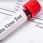 hepatitis